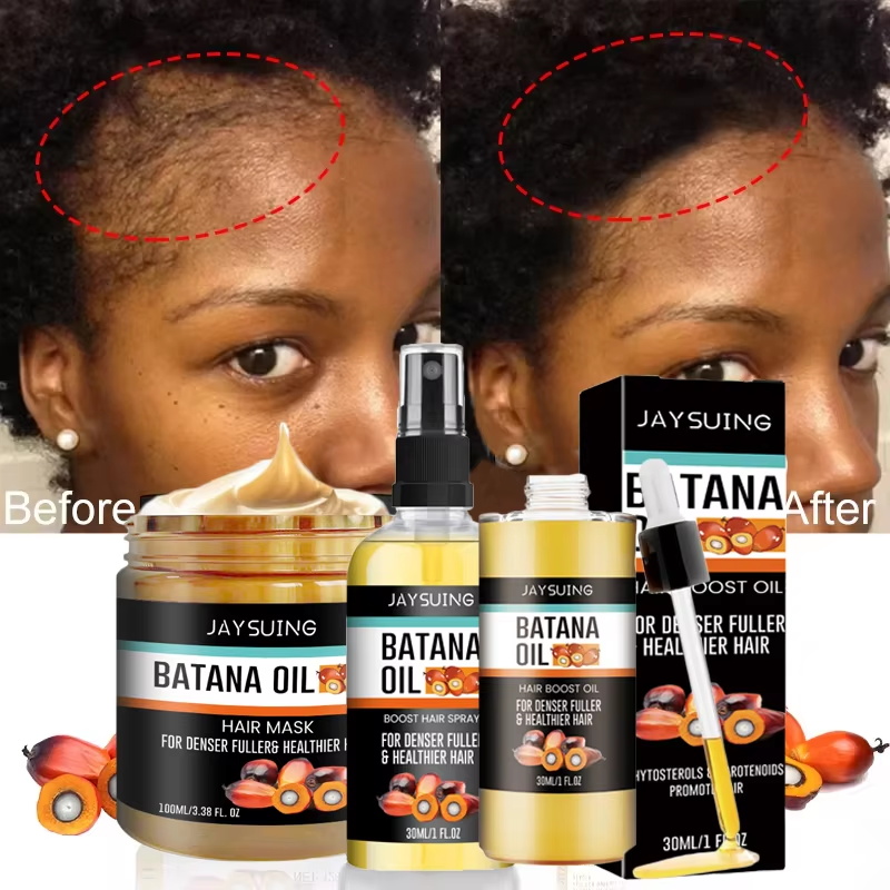 Hair Care Essence Oil - Batana Oil Thick Hair Serum Spray