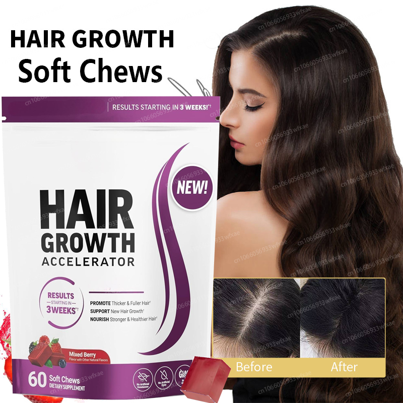 Hair Care Gummies - 3 Week Fast Hair Grow Gummies