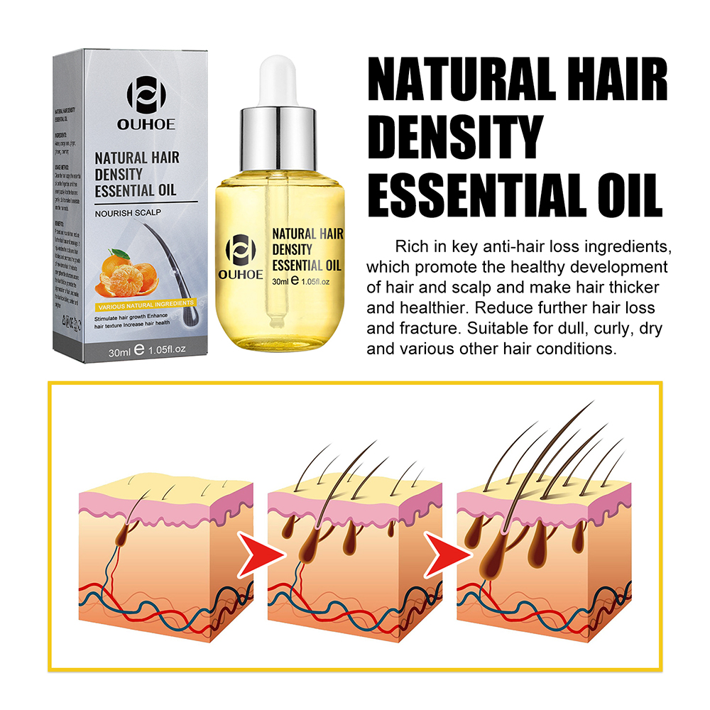 1/2PCS Ginger Hair Growth Oil  - Hair Care Ginseng recensione e prezzo