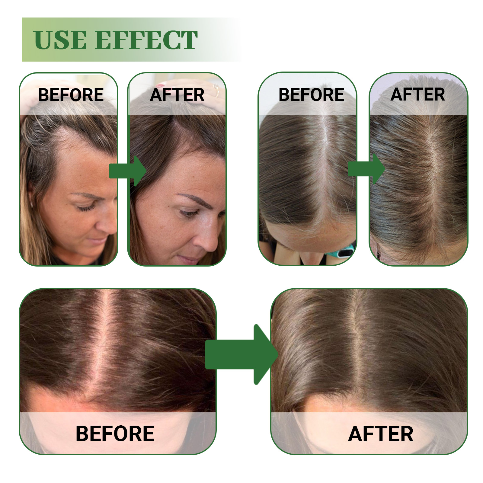 Hoegoa Rosemary Hair Repair Oi - Hair Care For Curly Dry Hair recensione e prezzo