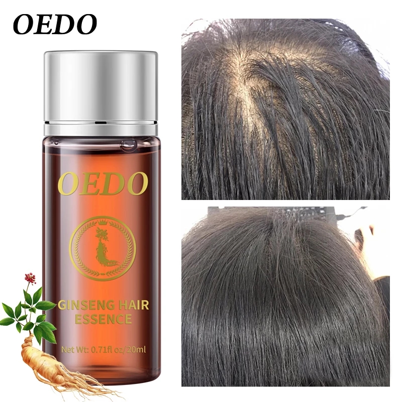 20ML Ginseng Hair Growth Essen - Hair Care Ginseng recensione e prezzo