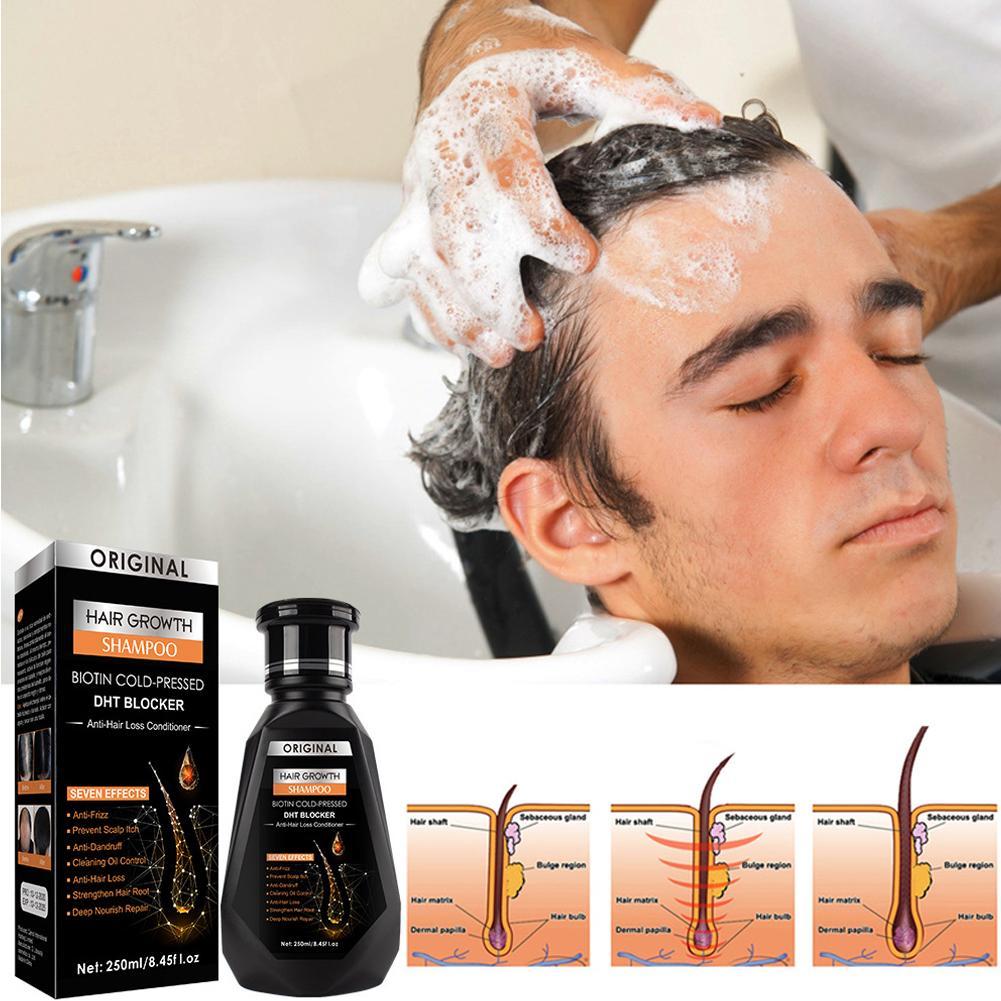 250ML Biotin Shampoo For Hair  - Biotin Shampoo Thickening recensione e prezzo