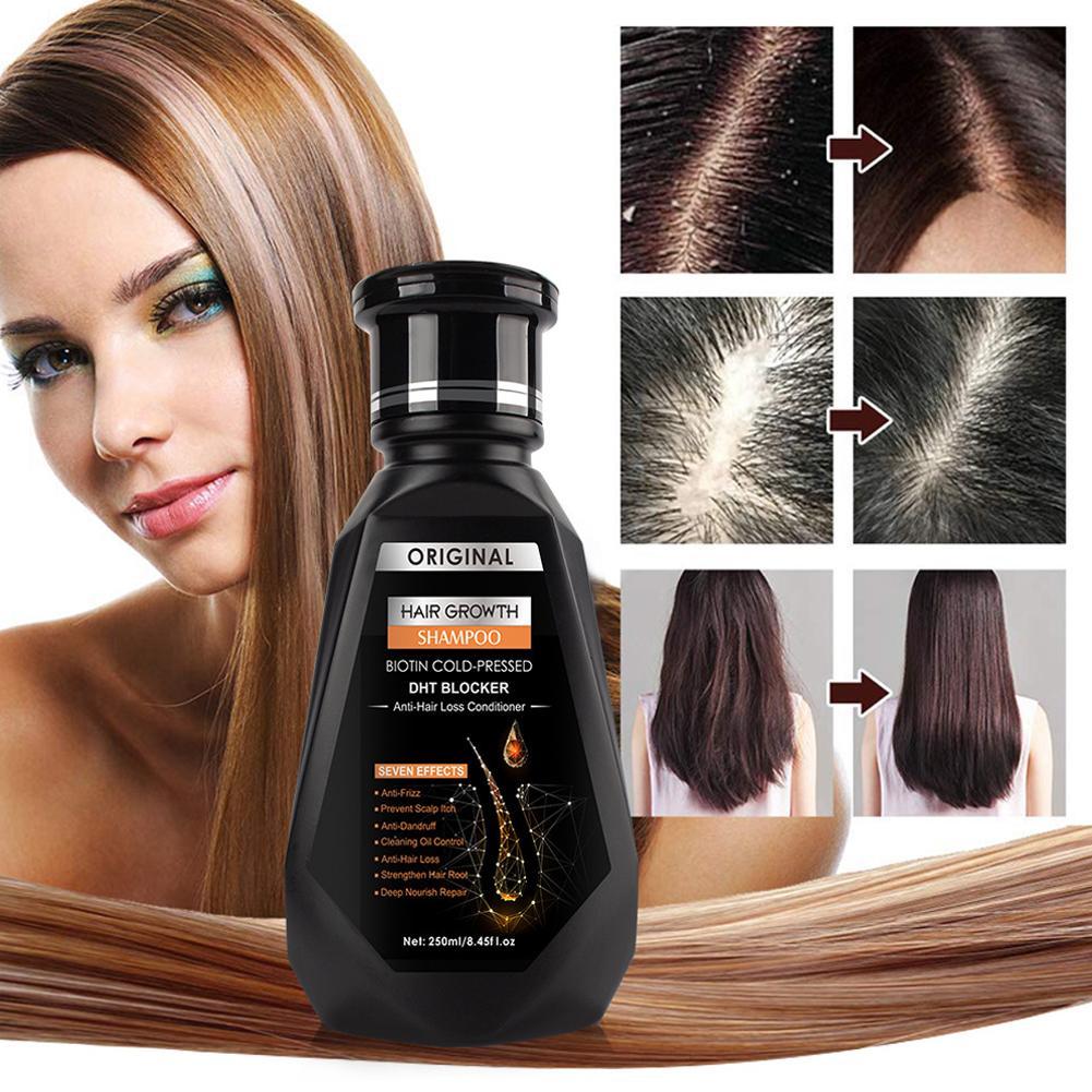 250ML Biotin Shampoo For Hair  - Biotin Shampoo Thickening recensione e prezzo
