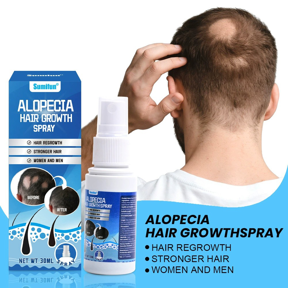 Alopecia Hair Growth Spray Sop - Hair Care Cream recensione e prezzo