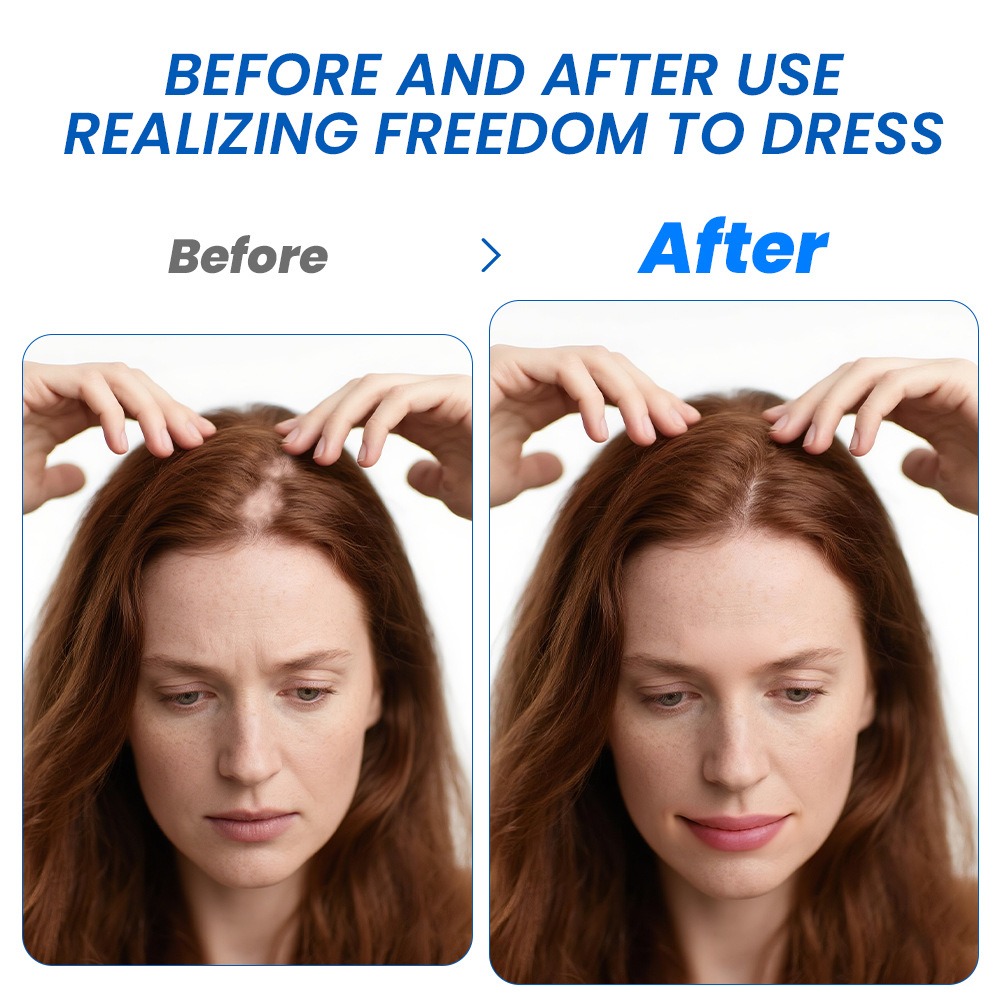 Alopecia Hair Growth Spray Sop - Hair Care Cream recensione e prezzo