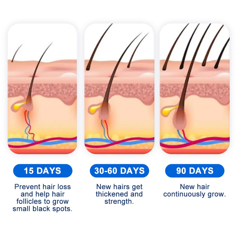 Alopecia Hair Growth Spray Sop - Hair Care Cream recensione e prezzo