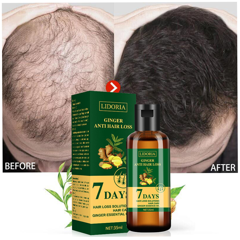 Ginger Hair Growth Essential O - Hair Care Essence Oil recensione e prezzo