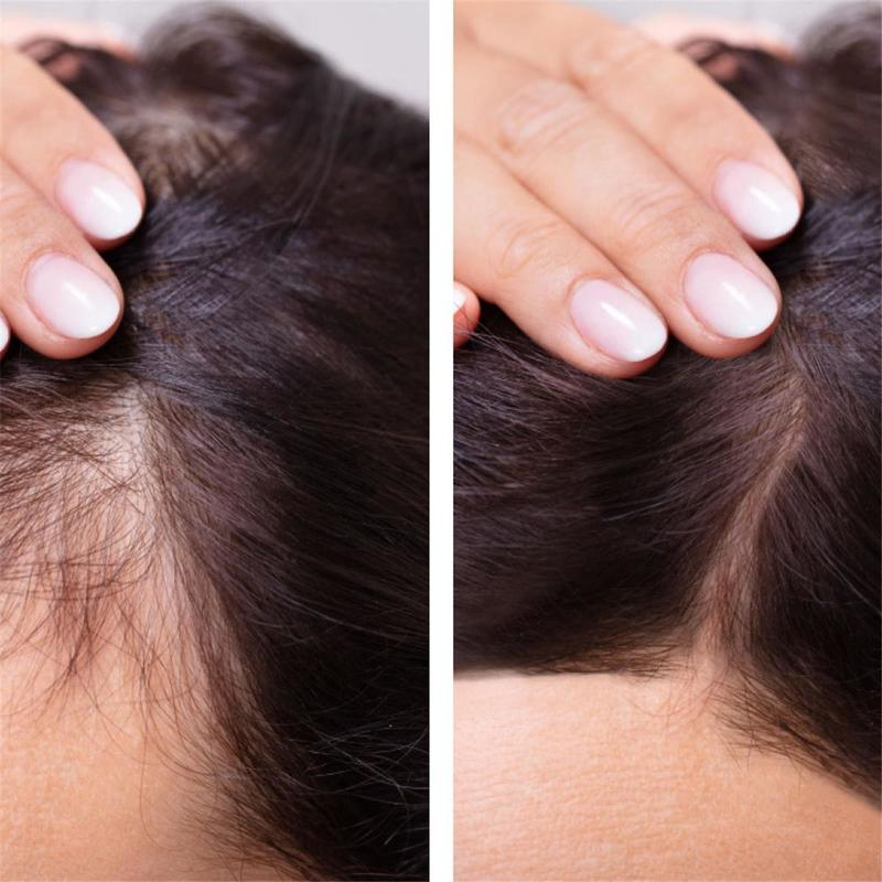 Ginger Hair Growth Essential O - Hair Care Essence Oil recensione e prezzo
