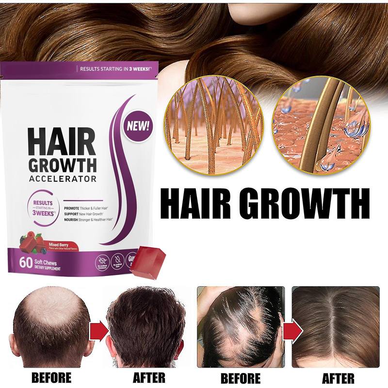 3 Week Fast Hair Grow Gummies  - Hair Care Gummies recensione e prezzo