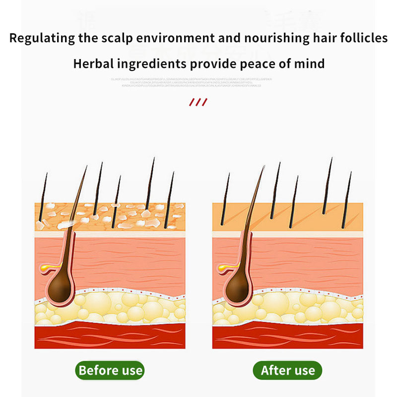 Sophora Flavescens Hair Follic - Hair Care Cream recensione e prezzo