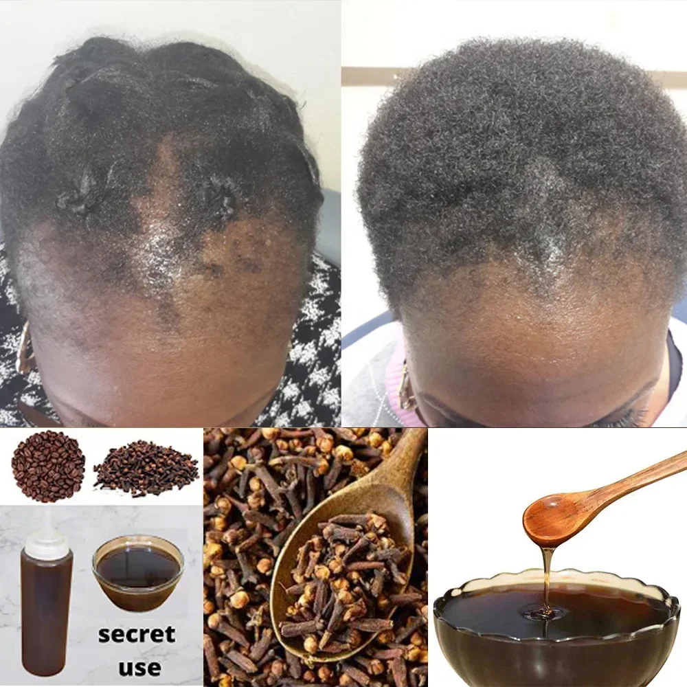 Africa Women Traction Alopecia - Hair Care Ginseng recensione e prezzo