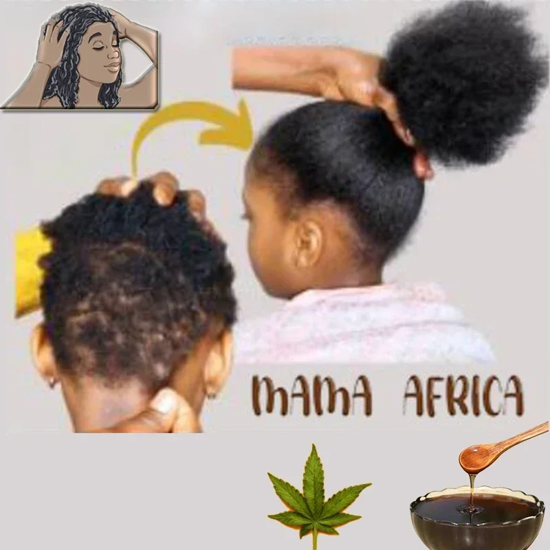 Africa Women Traction Alopecia - Hair Care Ginseng recensione e prezzo