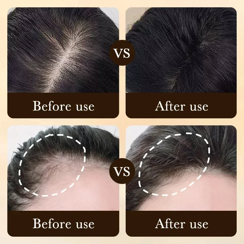 Biotin fast Hair Growth oil Pr - Hair Care Essence Oil recensione e prezzo