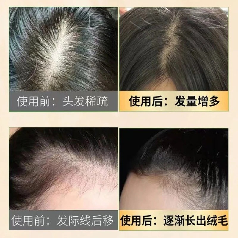 Natural Ginseng Hair Loss Care - Hair Care Ginseng recensione e prezzo