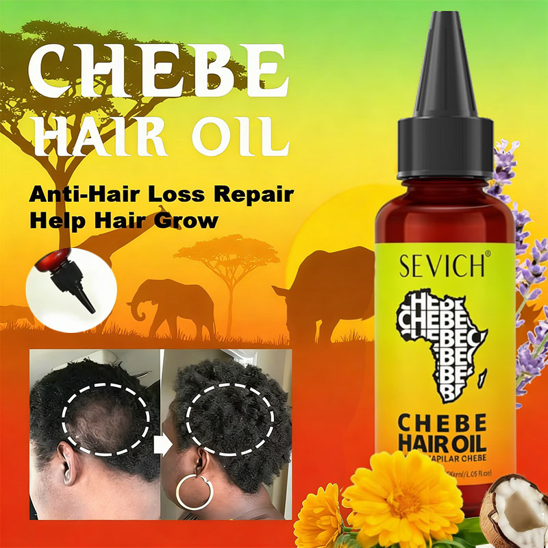 Chebe Fast Hair Growth Oil Afr - Hair Care Essence Oil recensione e prezzo