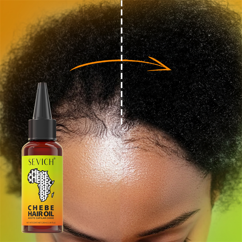 Chebe Fast Hair Growth Oil Afr - Hair Care Essence Oil recensione e prezzo