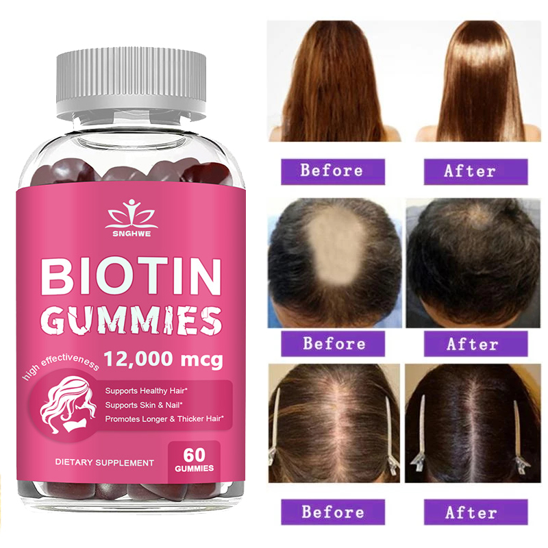 Collagen Gummies Biotin Gummie - Hair Care Gummies recensione e prezzo