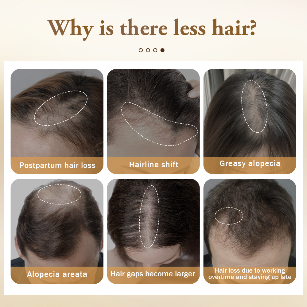 PURC Hair Growth Products for  - Hair Care Ginseng recensione e prezzo
