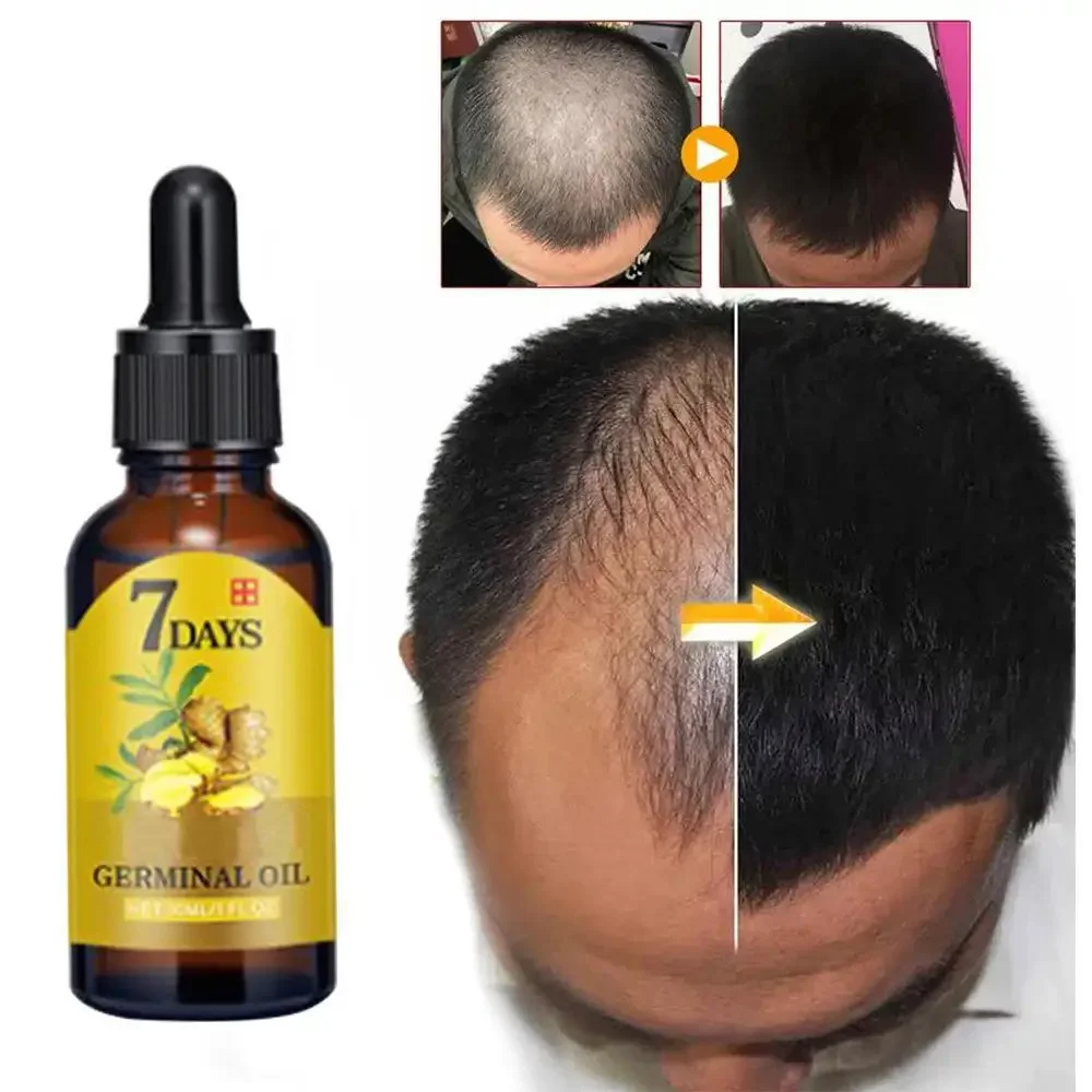 Hair Growth Ginger Fast Growin - Hair Care Essence Oil recensione e prezzo