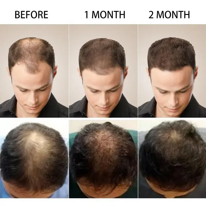 Hair Growth Ginger Fast Growin - Hair Care Essence Oil recensione e prezzo