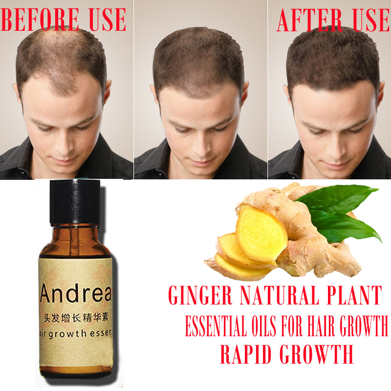 2/5/10Pcs Andrea Hair Growth S - Hair Care Essence Oil recensione e prezzo