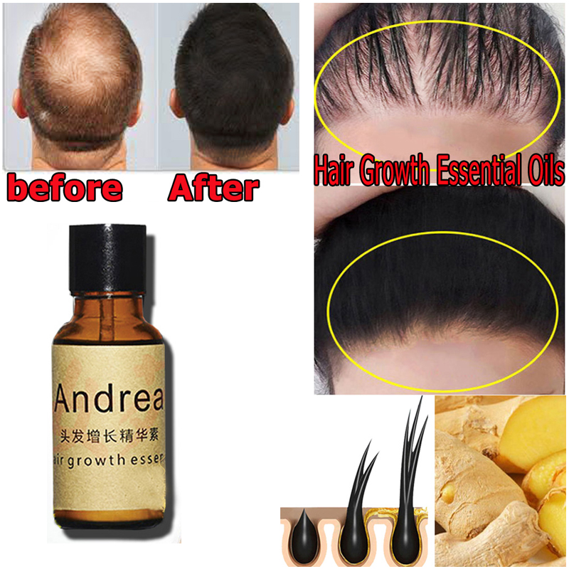 2/5/10Pcs Andrea Hair Growth S - Hair Care Essence Oil recensione e prezzo